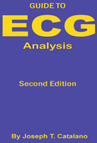 Ecg Analysis